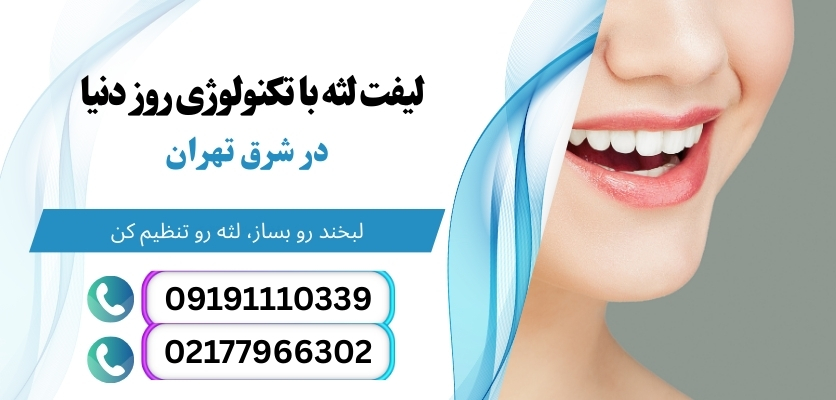 لیفت لثه با لیزر