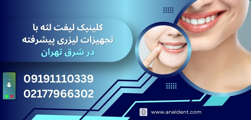 درمان لبخند لثه‌ای