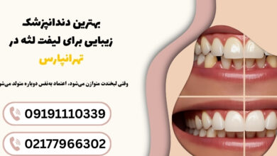 دلایل ایجاد لبخند لثه‌ای | شناخت علمی لبخندی که تعادل چهره را به‌هم می‌زند