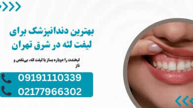 فقط یک اصلاح ساده در لثه‌ها، زندگی اجتماعی‌ات را دگرگون می‌کند! | راز لبخند هالیوودی فاش شد