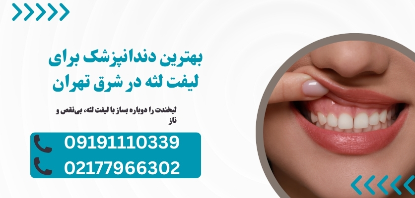 لیفت لثه در شرق تهران