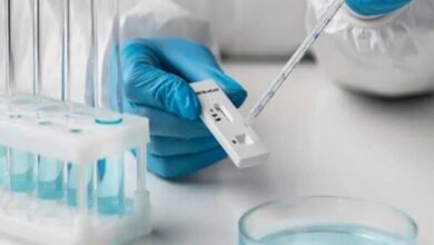 مشکلات تامین کیت‌ آزمایشگاه بیشتر شد