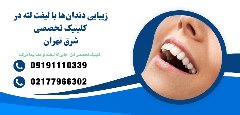جراحی لیفت لثه