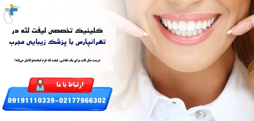 کلینیک لیفت لثه در تهران