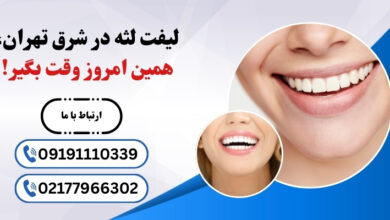 راز لبخند زیبا با لیفت لثه در شرق تهران | راهنمای کامل + نکات طلایی