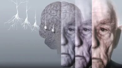 رمزگشایی از تفاوت‌های جنسیتی در ابتلا به زوال عقل