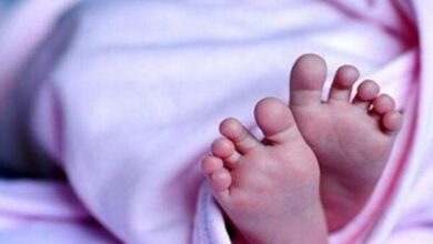 فتق کشاله ران در کودکان؛ لزوم مراجعه سریع به جراح