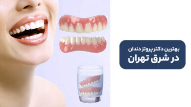 بهترین دکتر پروتز دندان در شرق تهران: تجربه، مهارت و اعتماد